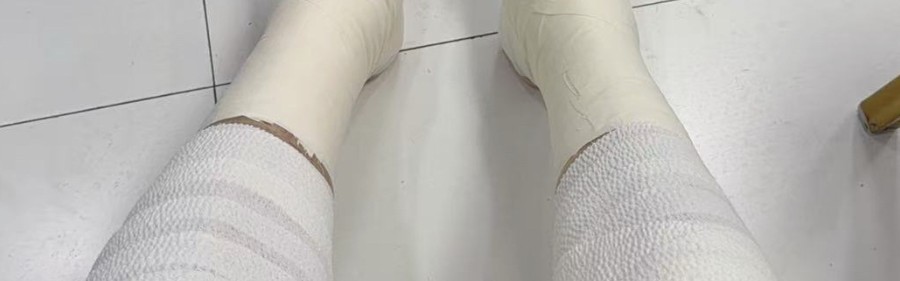 星空体育官网-胜山西谁注意翟晓川赛后伤势？双腿拉伤绑满绷带，看着都残忍！